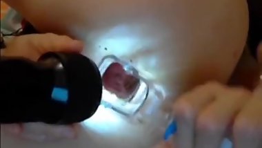 Russian girl in webcam with anal speculum