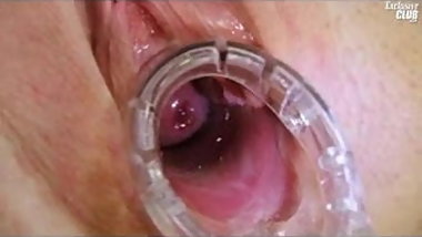 Super hot teen Jenny at the doctor